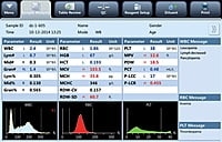 Hematology analyser, BeneSphera H-33s Hematology analyser, BeneSphera H-33s